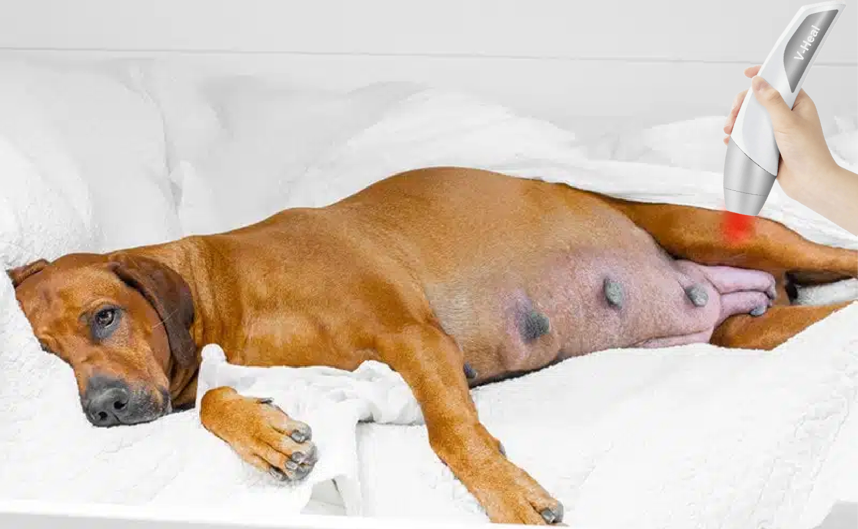 Is Laser Therapy Safe During Pregnancy?